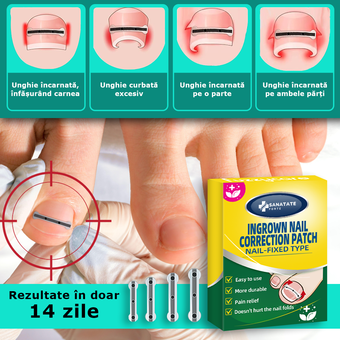 Set corectori unghii incarnate, 4 dimensiuni